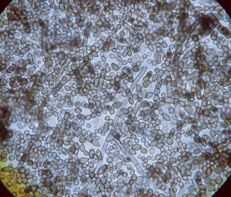 Một sinh vật đột biến đã được phát hiện ở Chernobyl, sở hữu những khả năng đặc biệt, bao gồm khả năng ăn bức xạ hạt nhân- Ảnh 4.