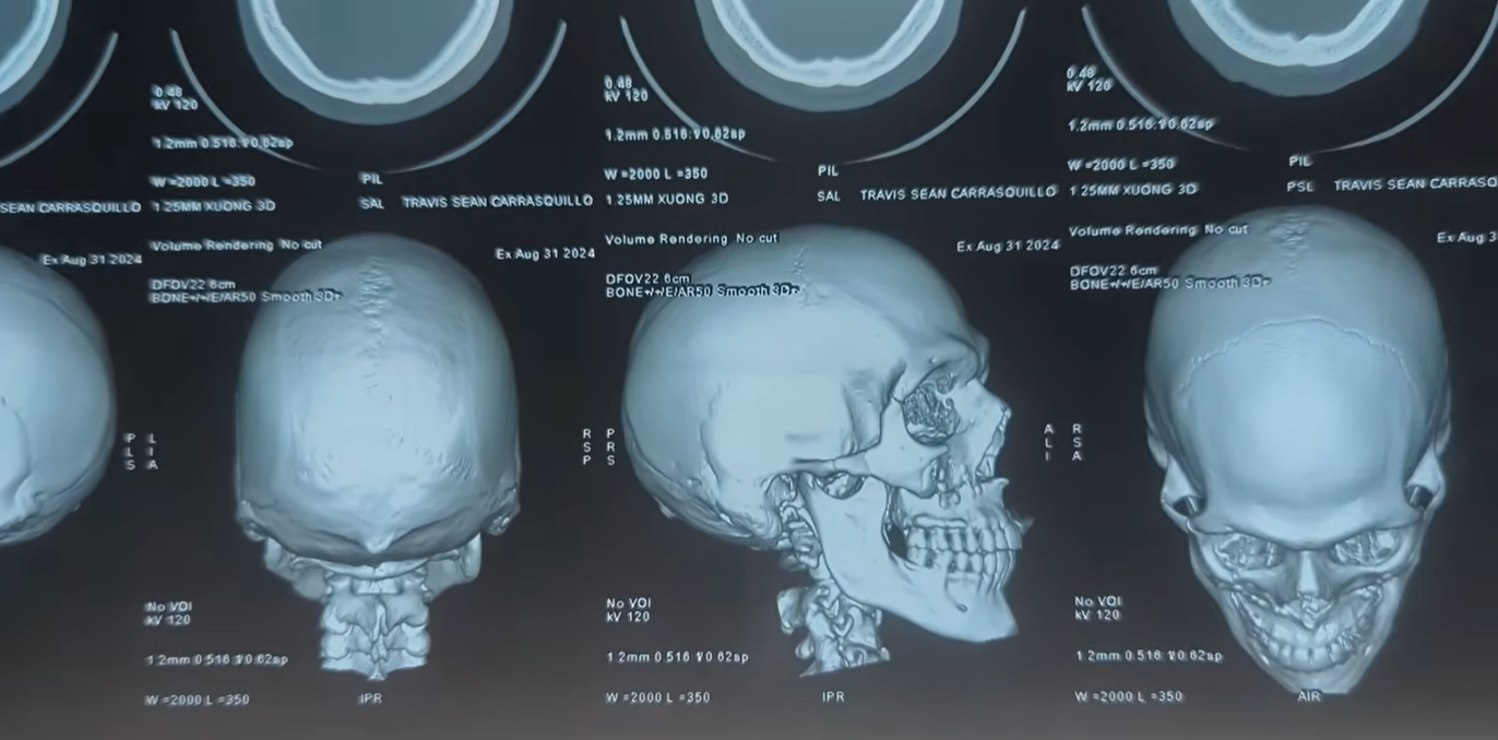 Khách Tây phẫu thuật tại 1 bệnh viện ở Đà Nẵng: "Nếu làm ở Mỹ, tôi sẽ phải nợ nần chồng chất trong ít nhất 10 năm"- Ảnh 3.