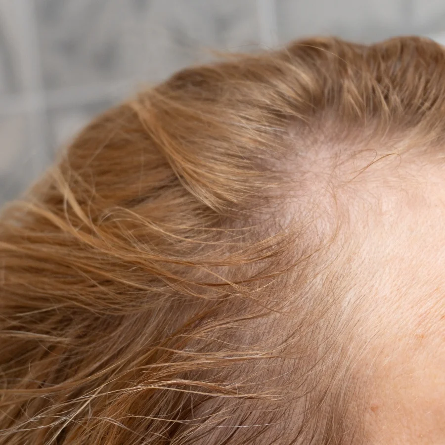 Lời khuyên cho người rụng tóc kinh niên, đừng bỏ qua 15 món ăn này- Ảnh 17.