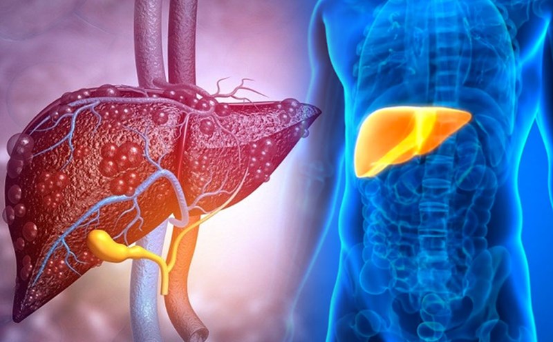 Nghiên cứu của Hàn Quốc trên 2,5 triệu người cho thấy: Trước 40 tuổi gặp vấn đề này sẽ tăng đáng kể nguy cơ ung thư- Ảnh 2.