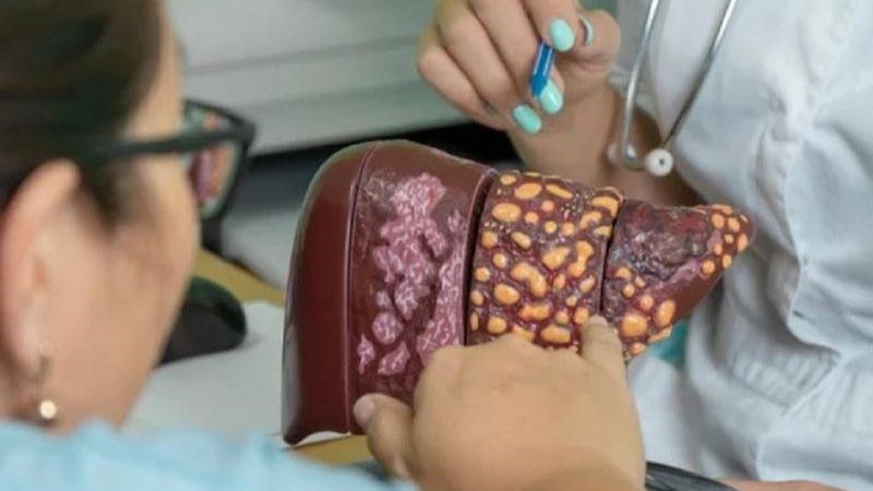 Nghiên cứu của Hàn Quốc trên 2,5 triệu người cho thấy: Trước 40 tuổi gặp vấn đề này sẽ tăng đáng kể nguy cơ ung thư- Ảnh 3.