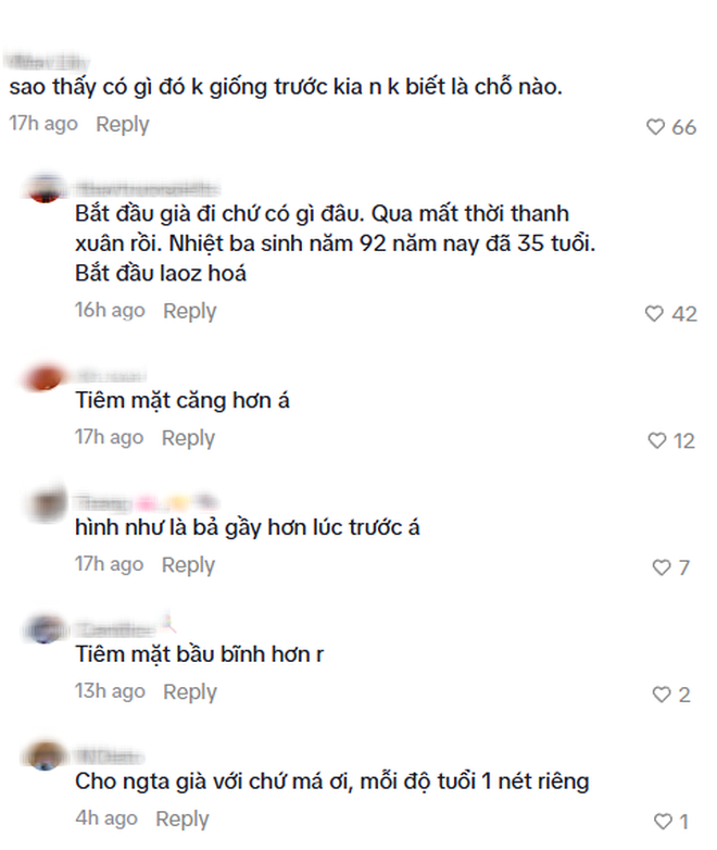 Địch Lệ Nhiệt Ba đã làm gì với gương mặt?- Ảnh 3.