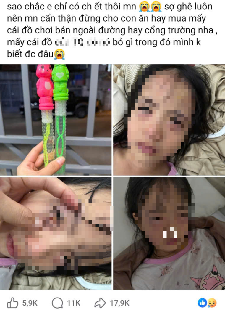 Bé gái 5 tuổi bị viêm kết mạc do đồ chơi thổi bong bóng xà phòng - Ảnh 1.