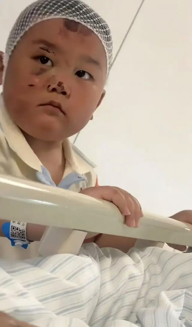 Bé trai 3 tuổi túc trực chăm mẹ sau tai nạn nghiêm trọng: Mặc dù chính bé bị nhiều vết thương đau đớn nhưng vẫn theo sát mẹ không rời- Ảnh 1.