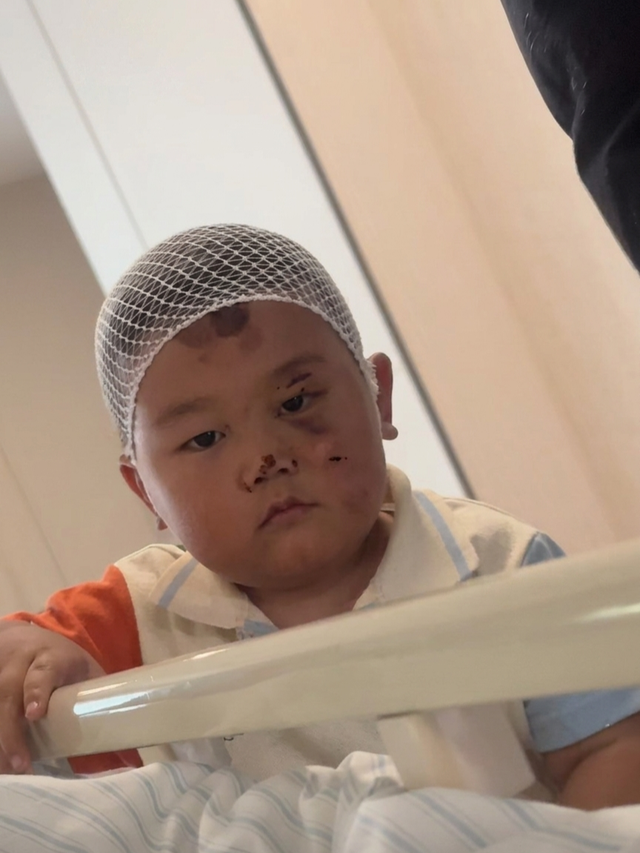 Bé trai 3 tuổi túc trực chăm mẹ sau tai nạn nghiêm trọng: Mặc dù chính bé bị nhiều vết thương đau đớn nhưng vẫn theo sát mẹ không rời- Ảnh 2.