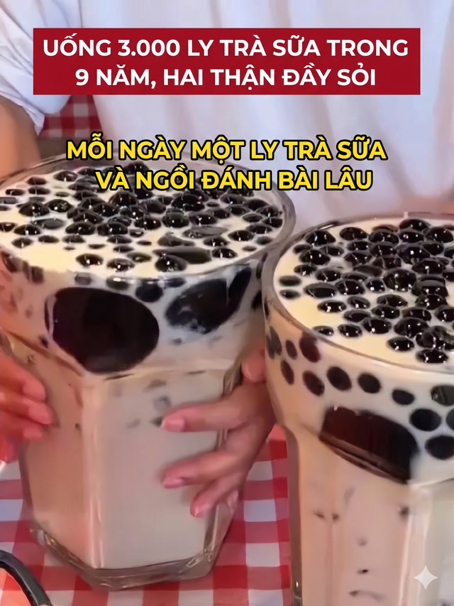 9 năm “nghiện” trà sữa thay nước lọc, uống tới 3.000 cốc: Người phụ nữ biến hai quả thận thành... túi đựng sỏi- Ảnh 2.