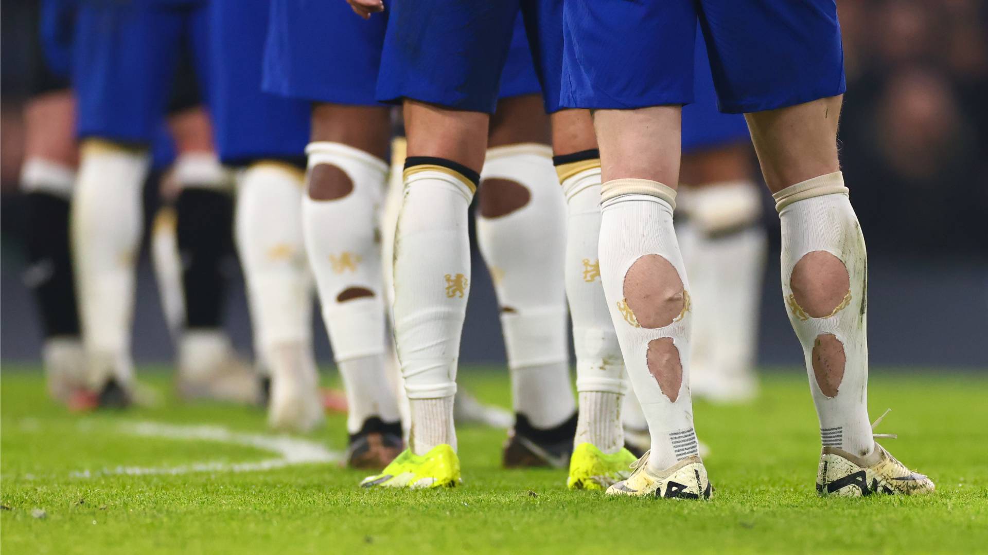 Phát hiện nhiều cầu thủ World Cup đi tất rách ra sân - Ảnh 2.