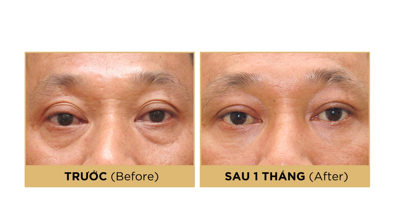 Đằng sau quyết định chỉnh mí là tầm nhìn lãnh đạo của nam doanh nhân- Ảnh 1. Đằng sau quyết định chỉnh mí là tầm nhìn lãnh đạo của nam doanh nhân- Ảnh 1.