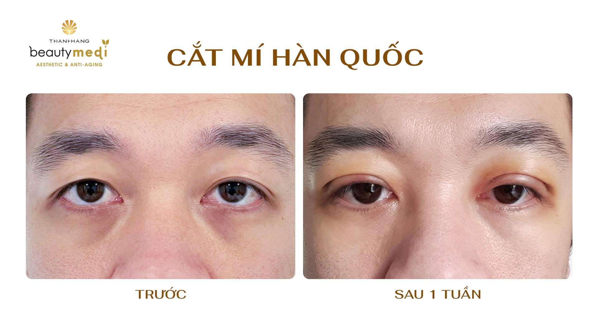 Đằng sau quyết định chỉnh mí là tầm nhìn lãnh đạo của nam doanh nhân- Ảnh 3. Đằng sau quyết định chỉnh mí là tầm nhìn lãnh đạo của nam doanh nhân- Ảnh 3.