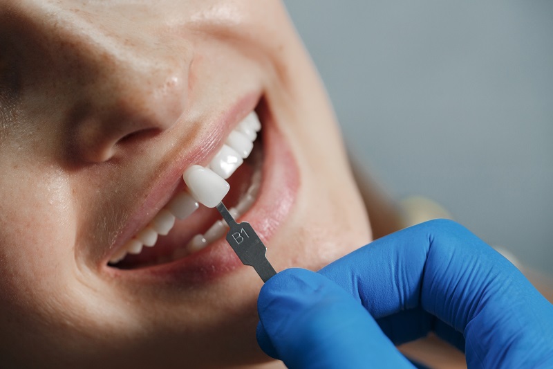 Vì sao nhiều người bọc răng sứ xong bị hôi miệng? - Ảnh 3.