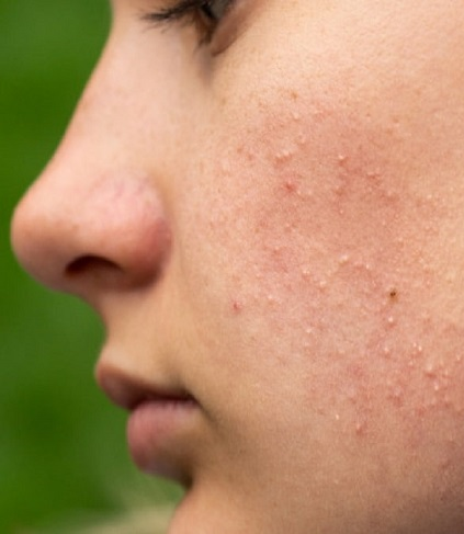 Ở Việt Nam có một loại cây, vừa giúp tóc óng mượt, vừa  kích thích tăng collagen cho da, đến phụ nữ Hàn cũng tận dụng làm đẹp mỗi tuần- Ảnh 3.