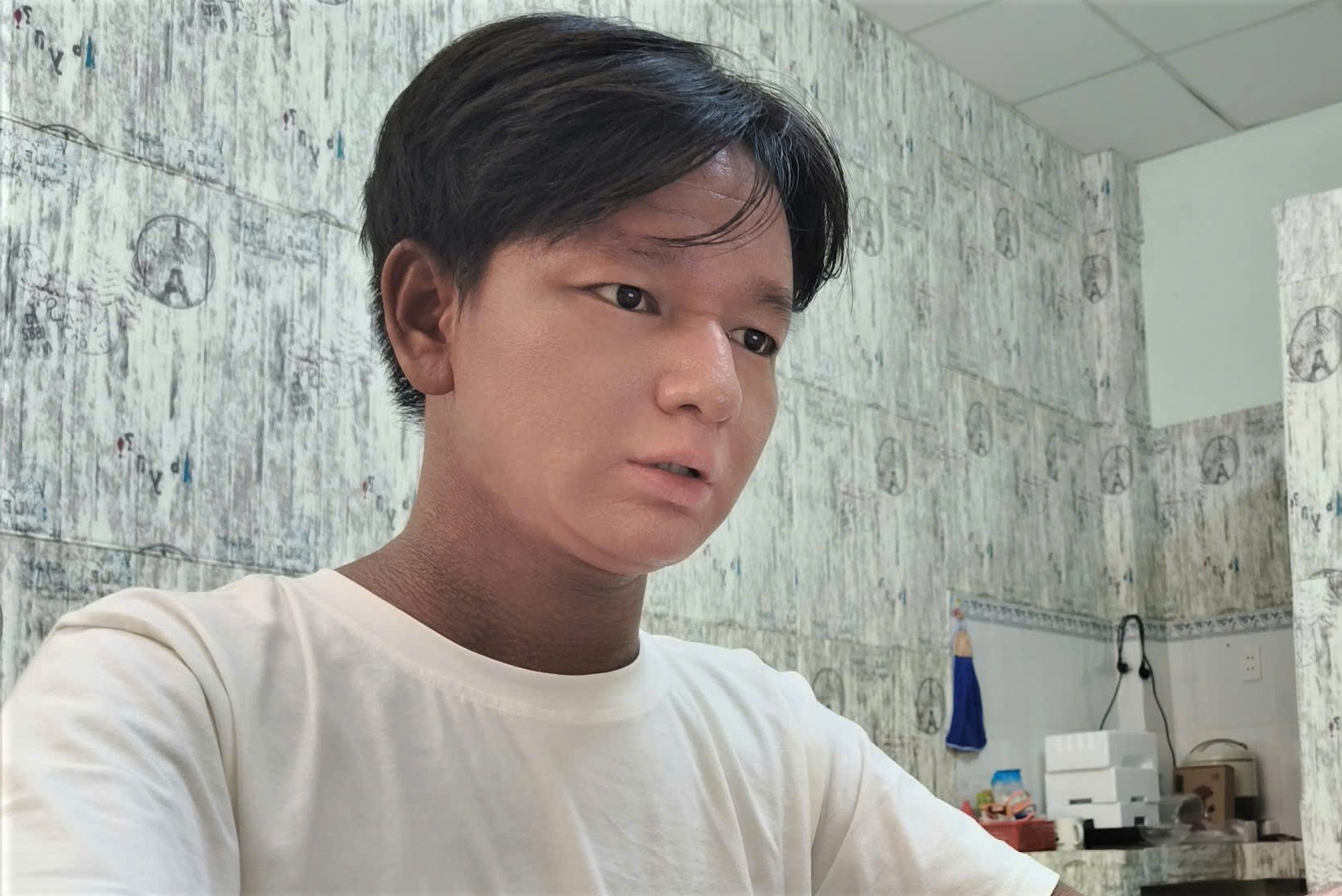 Cậu bé "người rắn" từng bị bạn bè xa lánh, 12 tuổi mới được vào lớp 1, giờ đã thành tân sinh viên- Ảnh 9.