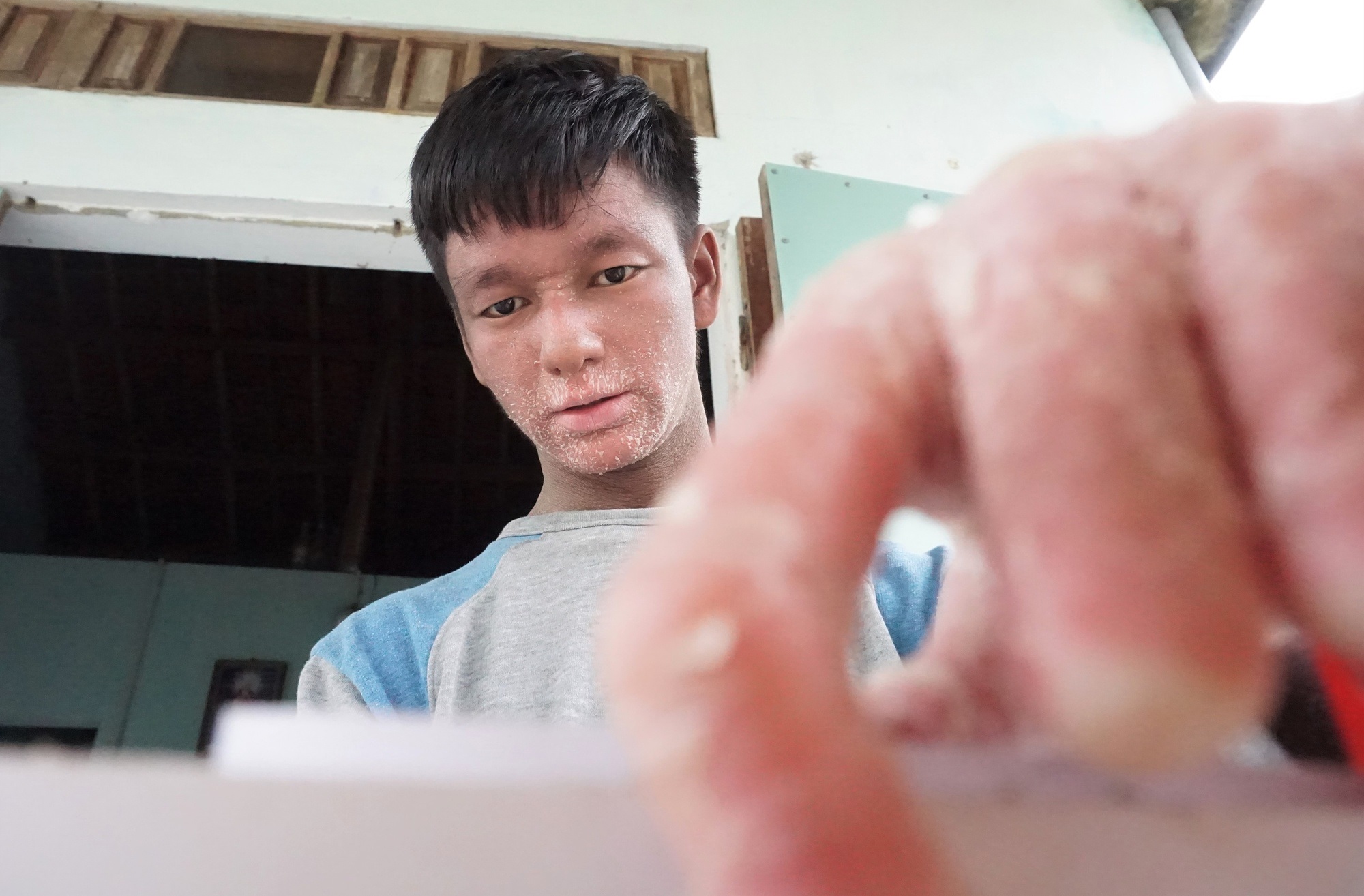 Cậu bé "người rắn" từng bị bạn bè xa lánh, 12 tuổi mới được vào lớp 1, giờ đã thành tân sinh viên- Ảnh 2.