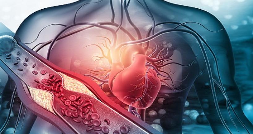 Bác sĩ nói thẳng: 5 món vạn người mê nhưng ăn càng nhiều tim càng nhanh "hỏng"- Ảnh 1.