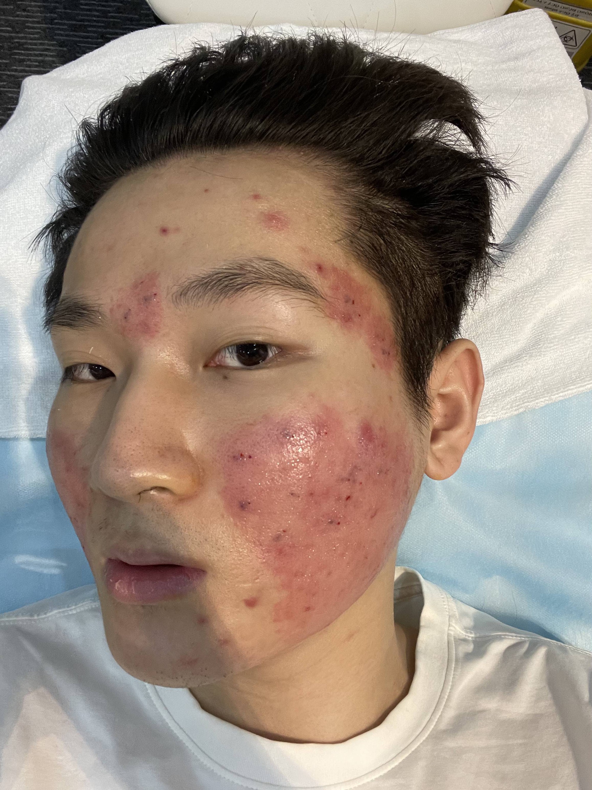 Hành trình thành Beauty Blogger của Bimm và 3 bức ảnh từng không dám cho ai nhìn thấy- Ảnh 2. Hành trình thành Beauty Blogger của Bimm và 3 bức ảnh từng không dám cho ai nhìn thấy- Ảnh 2.