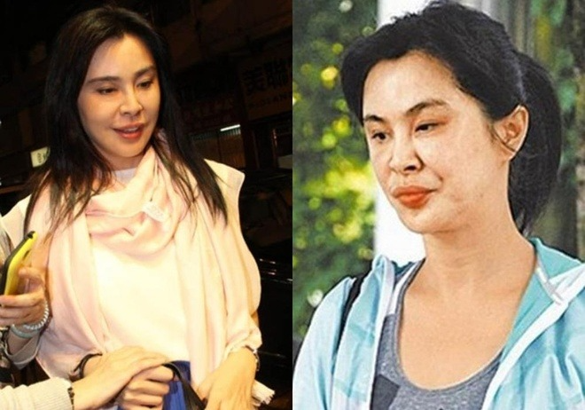 "Ngọc nữ đẹp khuynh đảo châu Á" tháo chạy khỏi showbiz nay đi châm cứu massage, nhan sắc biến dạng xuống cấp khó tin - Ảnh 7.