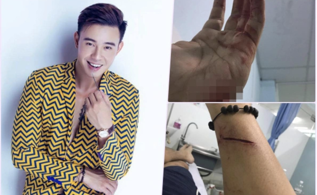 Ca sĩ Việt hát ca khúc 10 tỷ view vang danh Đại lễ: Gánh nợ 28 tỷ ở tuổi 20, đoạn tâm thư thấy rõ sự thật   - Ảnh 4.