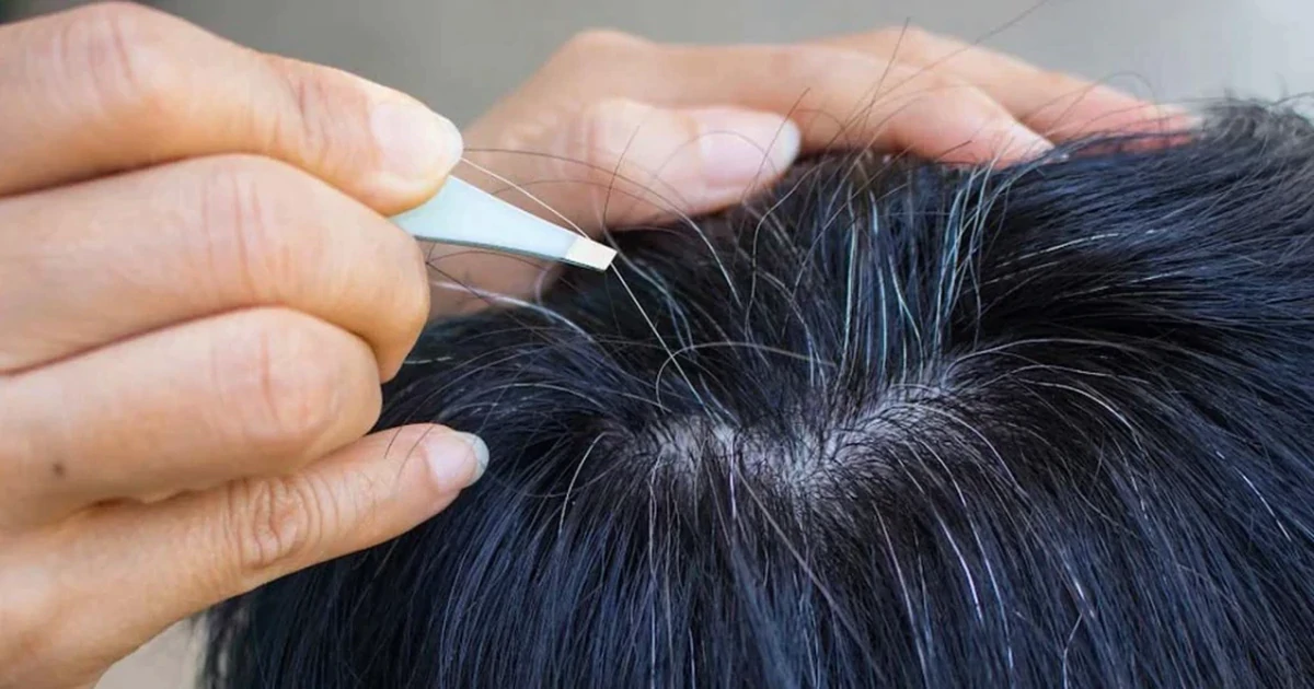 Lời khuyên cho những ai có tóc bạc sớm