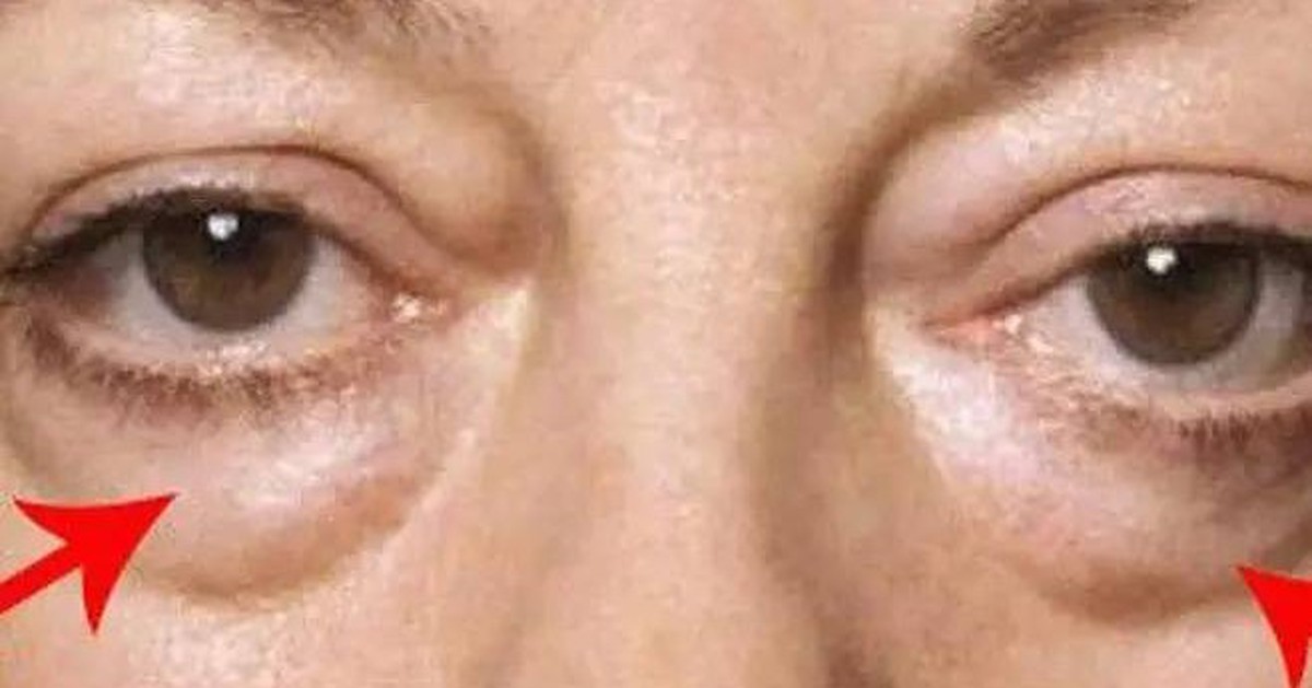 9 dấu hiệu bệnh lý thể hiện rõ trên khuôn mặt