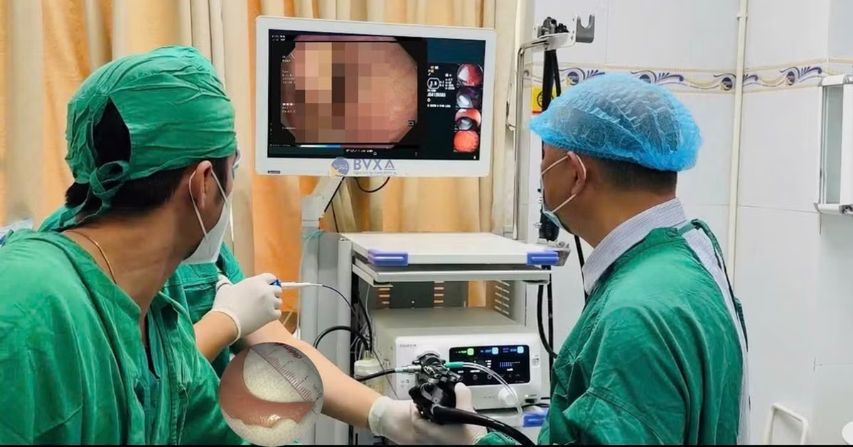 Đang uống nước, người đàn ông 51 tuổi bất ngờ nuốt nhầm thứ khó tin