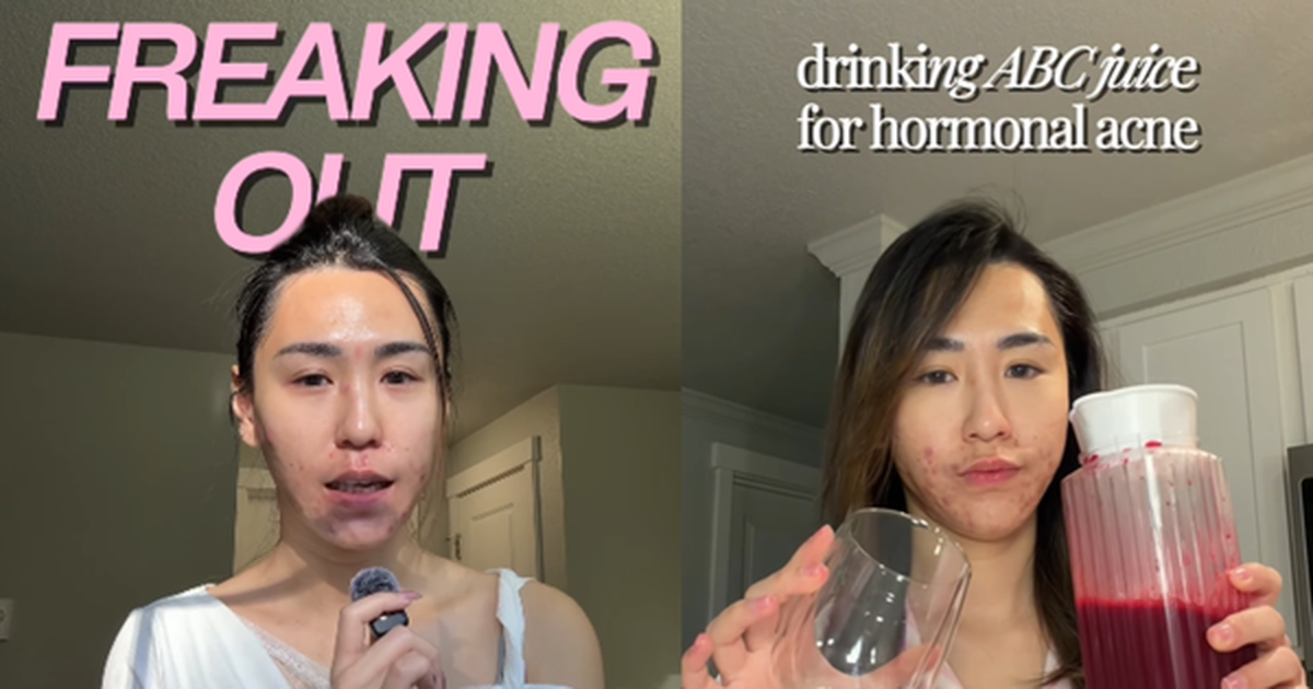 Bị đuổi việc, cô gái 27 tuổi để mặt mộc với mảng mụn lớn lên mạng tâm sự và cái kết bất ngờ