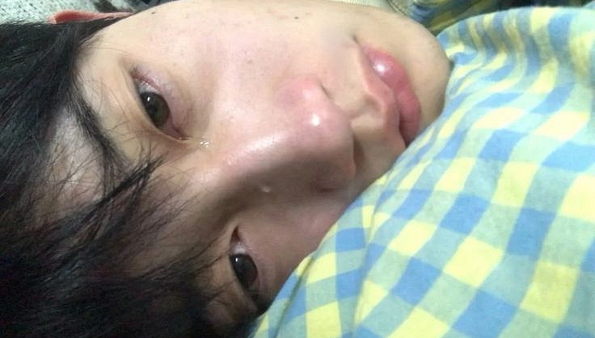 Bác sĩ nhắc nhở 6 triệu chứng phổ biến nhất của ung thư ruột: Tiếc là rất nhiều người bỏ qua, tưởng là… "ốm vặt"