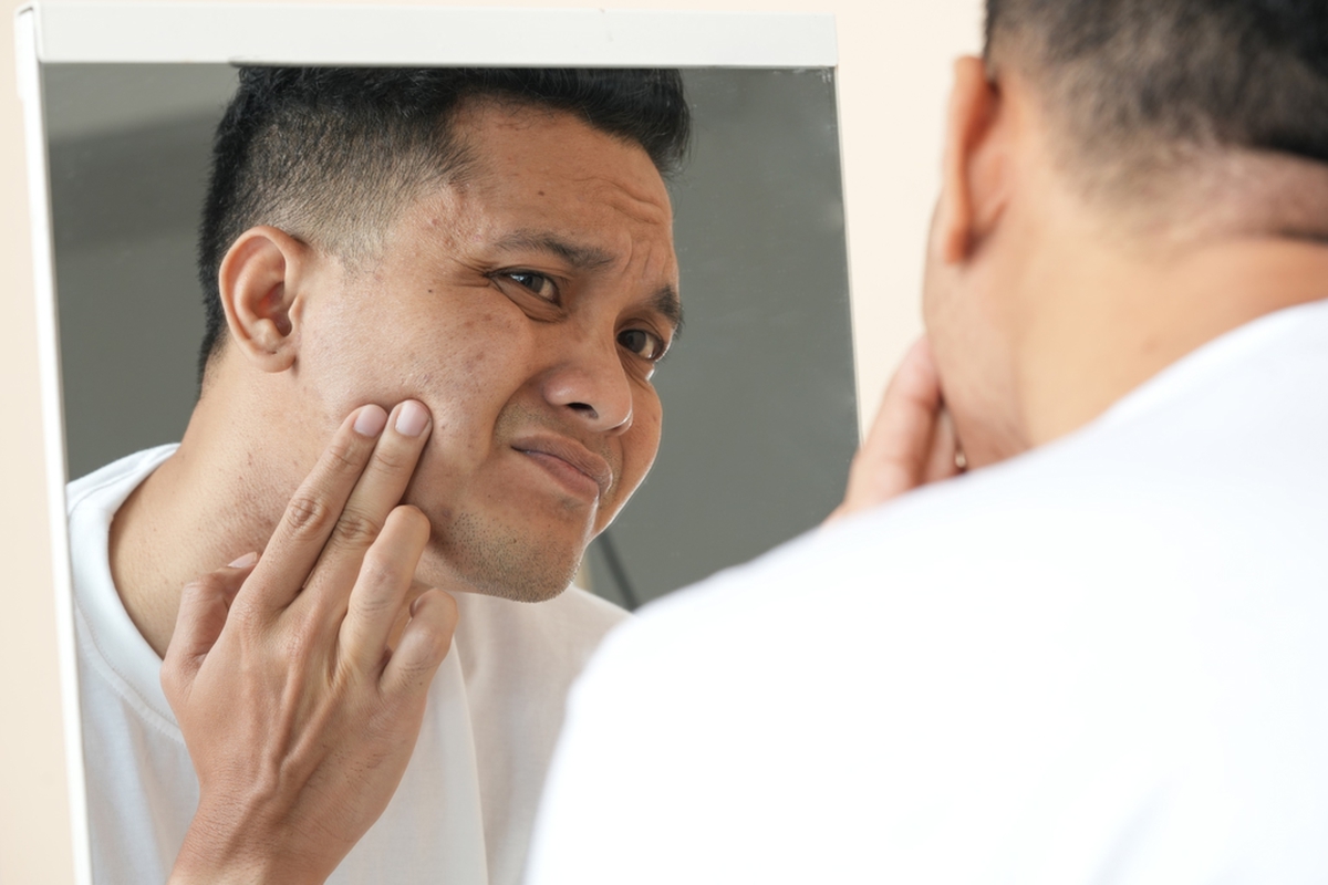 Triệu chứng ban đầu của bệnh tiểu đường có thể xuất hiện trên mặt: Thấy 7 dấu hiệu này, hãy đi khám ngay