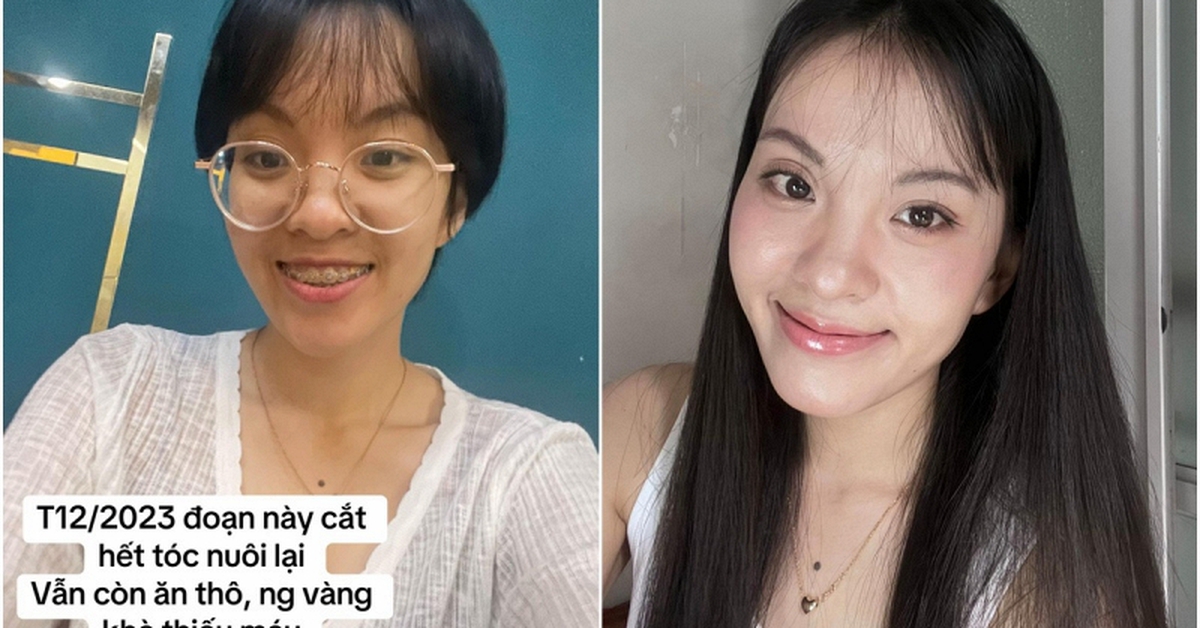 Màn thay đổi "đáng đồng tiền" của cô gái TP.HCM sau khi từ bỏ ăn thô, niềng răng và mổ mắt cận