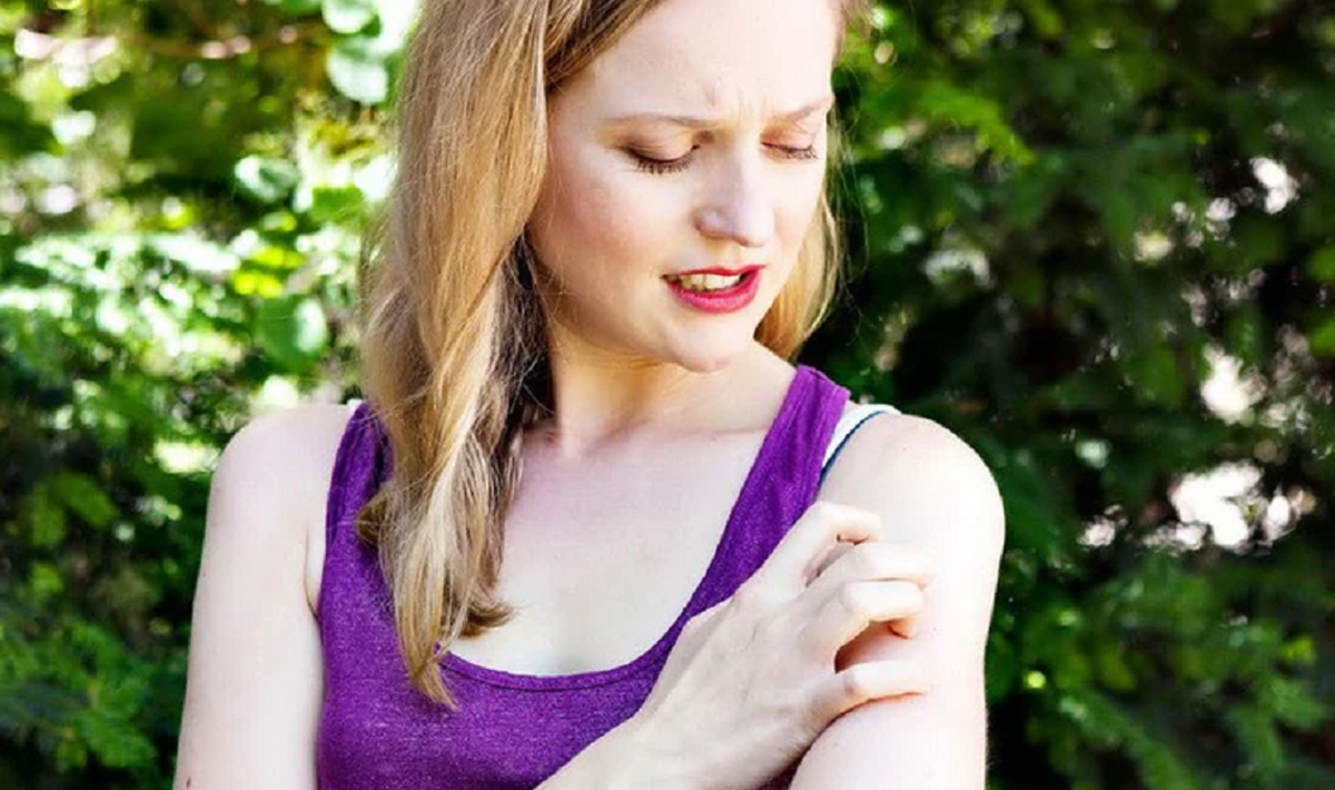 Câu nói "người xinh đẹp thường thu hút muỗi" có hoàn toàn vô lý?