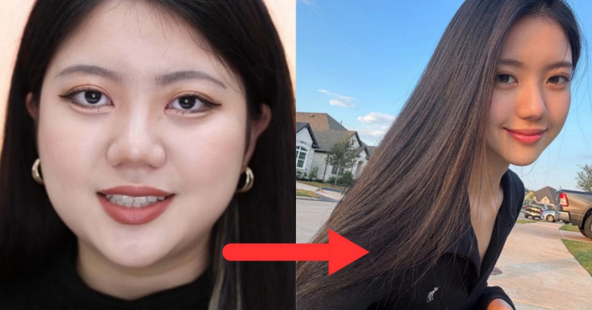 Sức mạnh của việc giảm 12kg: Cô gái thành nữ thần trong phút mốt, mặt gọn đi phân nửa nhờ 1 công thức duy nhất