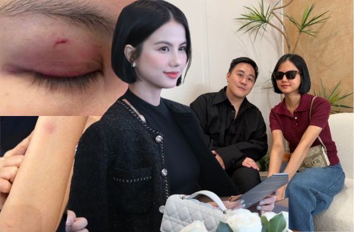 Động thái mới của nữ bác sĩ sau khi Trung Quân idol gặp mặt xin lỗi