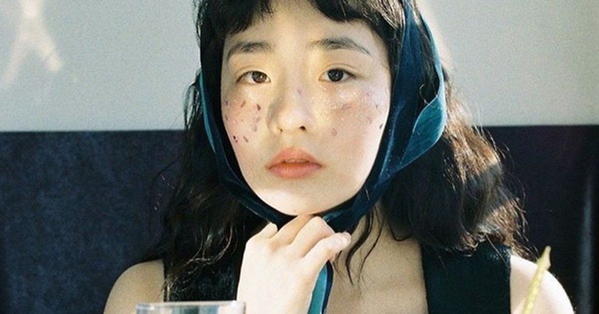 Các bác sĩ khuyên: Không cần chờ tới lúc ngứa da, thấy 7 dấu hiệu này trên mặt tức là máu đã "ngập đường"