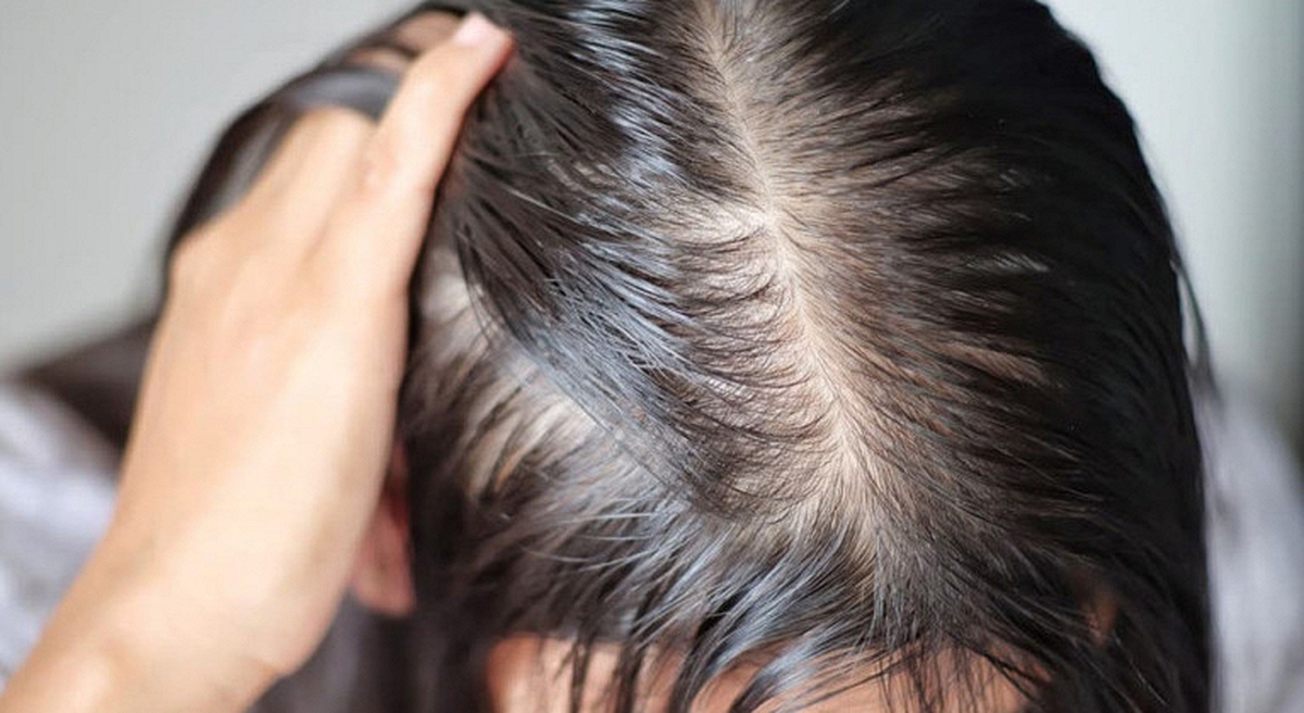 Lời khuyên cho những người hay bị rụng tóc