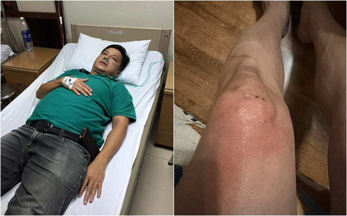 NSƯT Chí Trung mắc bệnh lạ