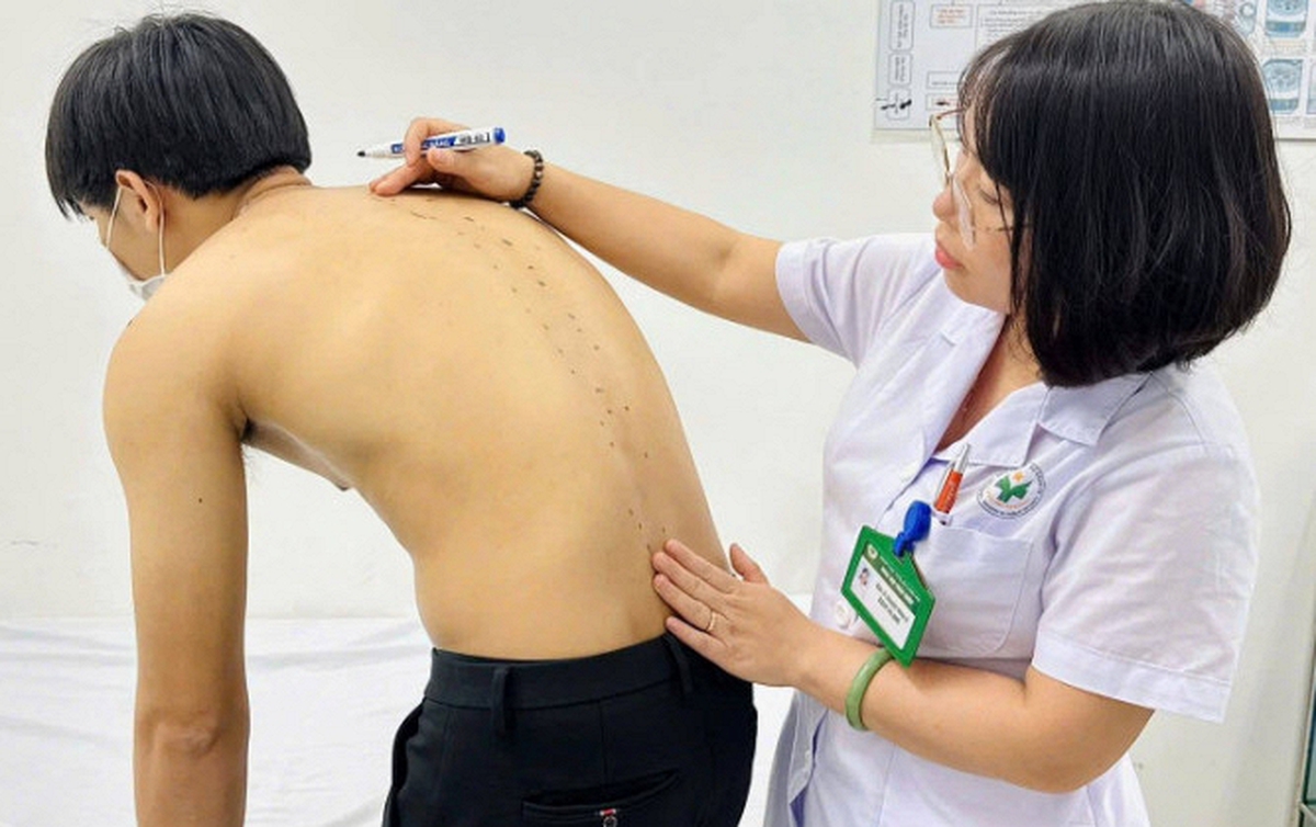 Thanh niên 20 tuổi đa u lưng âm ỉ suốt 6 tháng, bác sĩ chỉ rõ căn bệnh mạn tính nguy hiểm: Chủ quan dễ chịu khổ cả đời