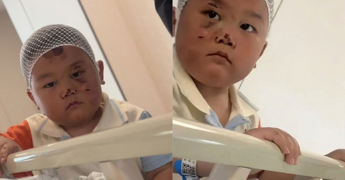 Bé trai 3 tuổi túc trực chăm mẹ sau tai nạn nghiêm trọng: Mặc dù chính bé bị nhiều vết thương đau đớn nhưng vẫn theo sát mẹ không rời