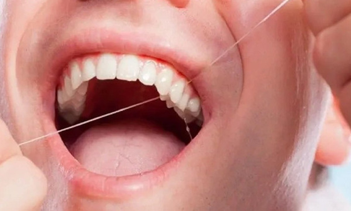 Lời khuyên cho những người sử dụng chỉ nha khoa hàng ngày