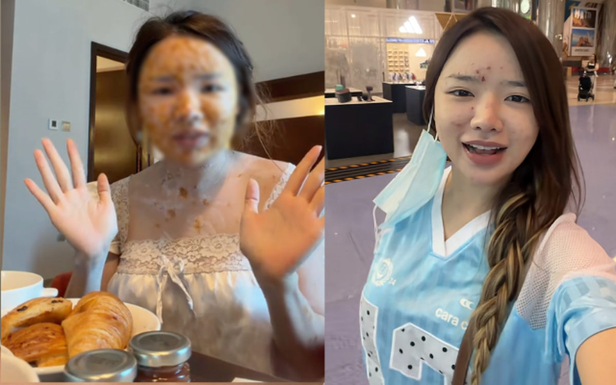 Sau gần nửa tháng cách ly tại Dubai vì mắc thủy đậu, TikToker Việt cập nhật tình trạng hiện tại khi qua cửa hải quan