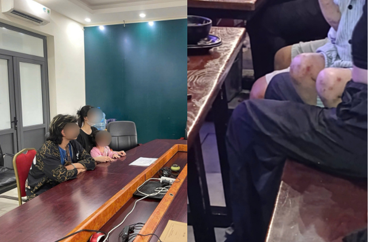 Mẹ của bé gái đưa con đến quán bia tại Hà Nội lý giải thế nào về các vết thâm trên chân, nghi bị bạo hành?