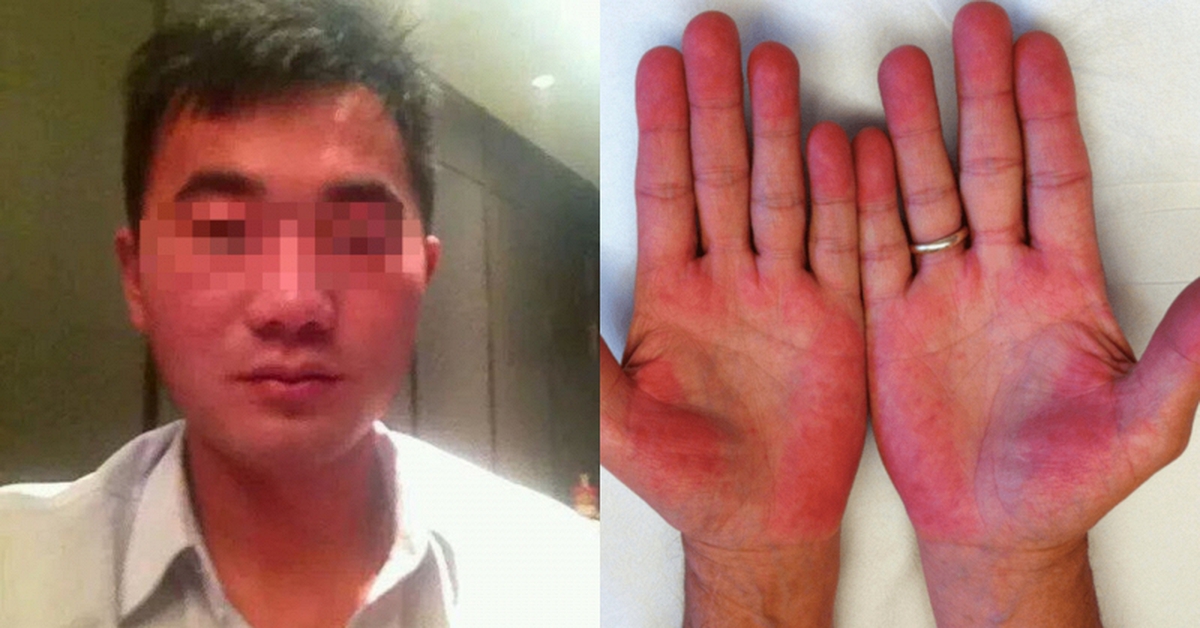 Người đàn ông không bia rượu nhưng ngày nào cũng bị kiểm tra nồng độ cồn, biết sự thật phía sau ai cũng xót xa