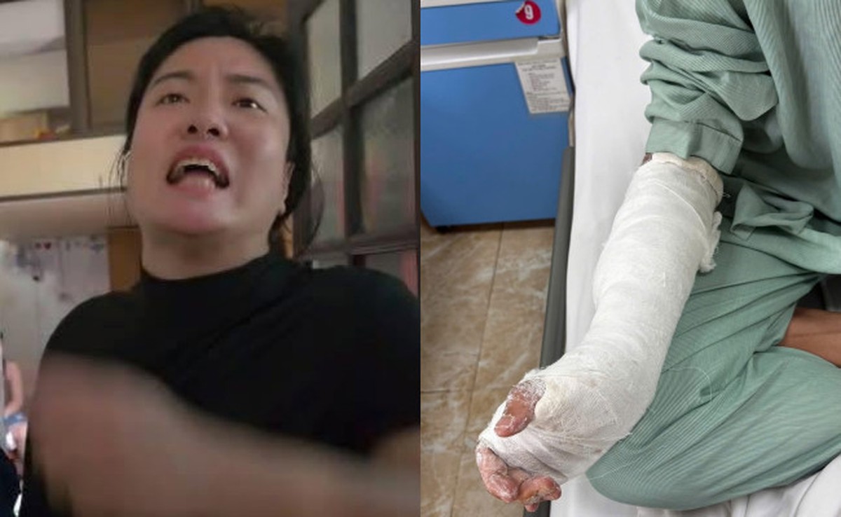 Bị khách "bùng" tiền 30 bánh chưng, chém nhập viện: Tình trạng sức khỏe của chủ quán