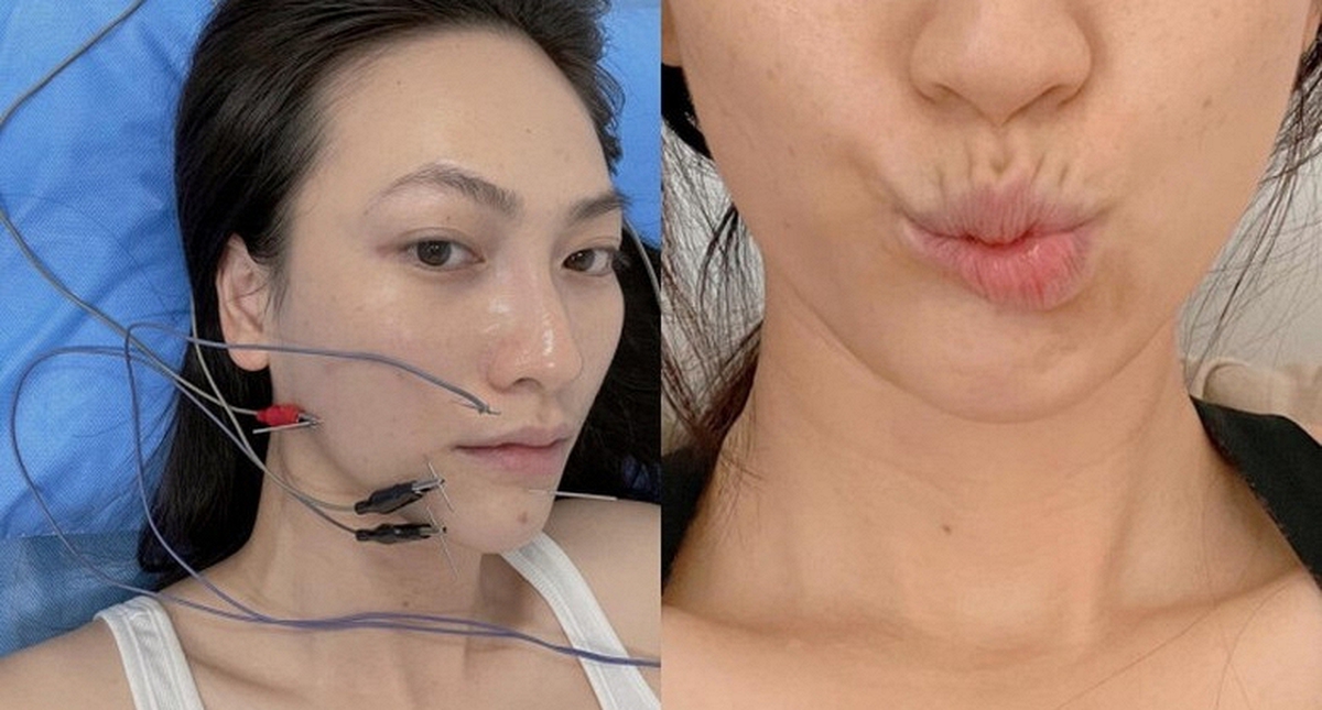 Nữ chính phim trăm tỷ của Trấn Thành: Từng đi bán xôi lề đường, bị biến chứng sau ca mổ tuyến giáp