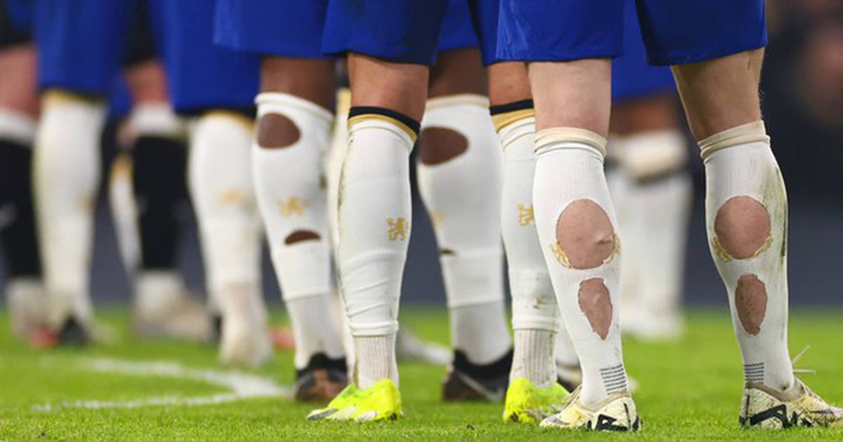 Phát hiện nhiều cầu thủ World Cup đi tất rách ra sân