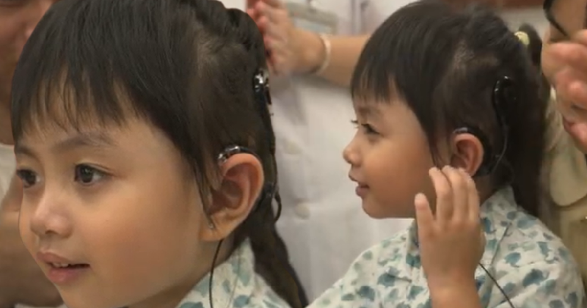 Bé gái Hà Nội lần đầu nghe được tiếng nói của mẹ: Ca cấy điện cực ốc tai gây xúc động tại Bệnh viện Nhi