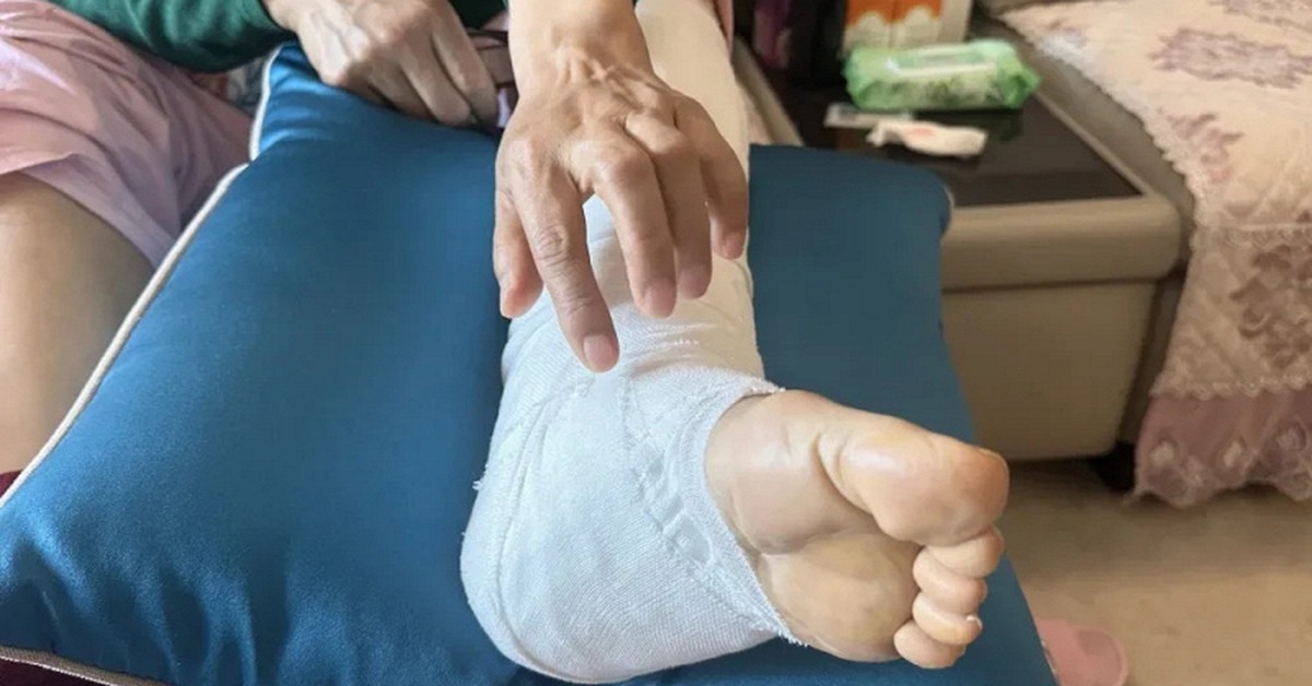 Xem nhẹ nốt ruồi ở nơi cực hiếm ai để ý, người phụ nữ "hối không kịp" vì ung thư đã di căn