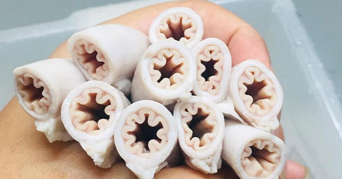 Bác sĩ tiết lộ sự thật về lòng se điếu: Ai ăn kiểu này dễ nhiễm ký sinh trùng
