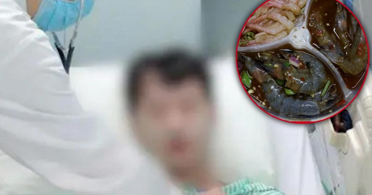 Người đàn ông suýt chết sau khi ăn hải sản theo kiểu "vạn người mê”: Nhiễm amip ăn não, xuất huyết ruột, nhiễm trùng toàn thân