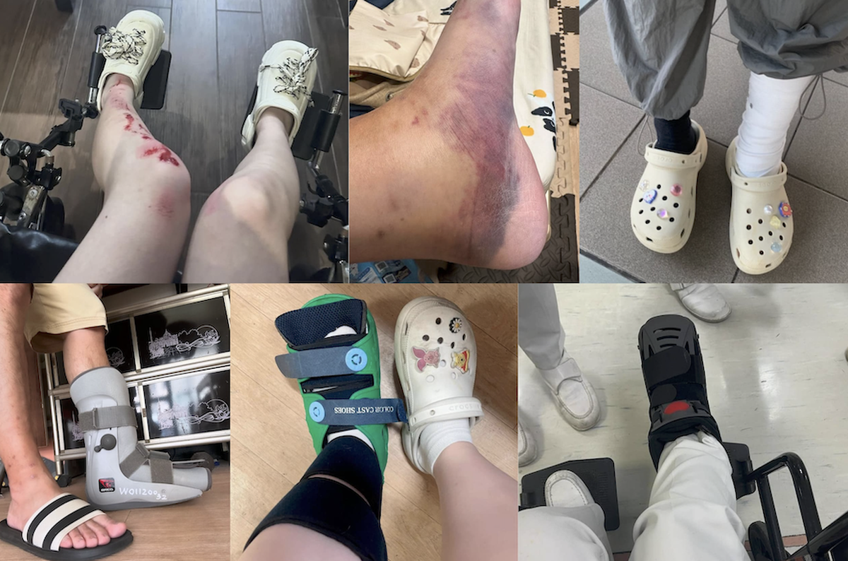 Lời khuyên cho những người thích đi dép sục, dép "kiểu crocs"