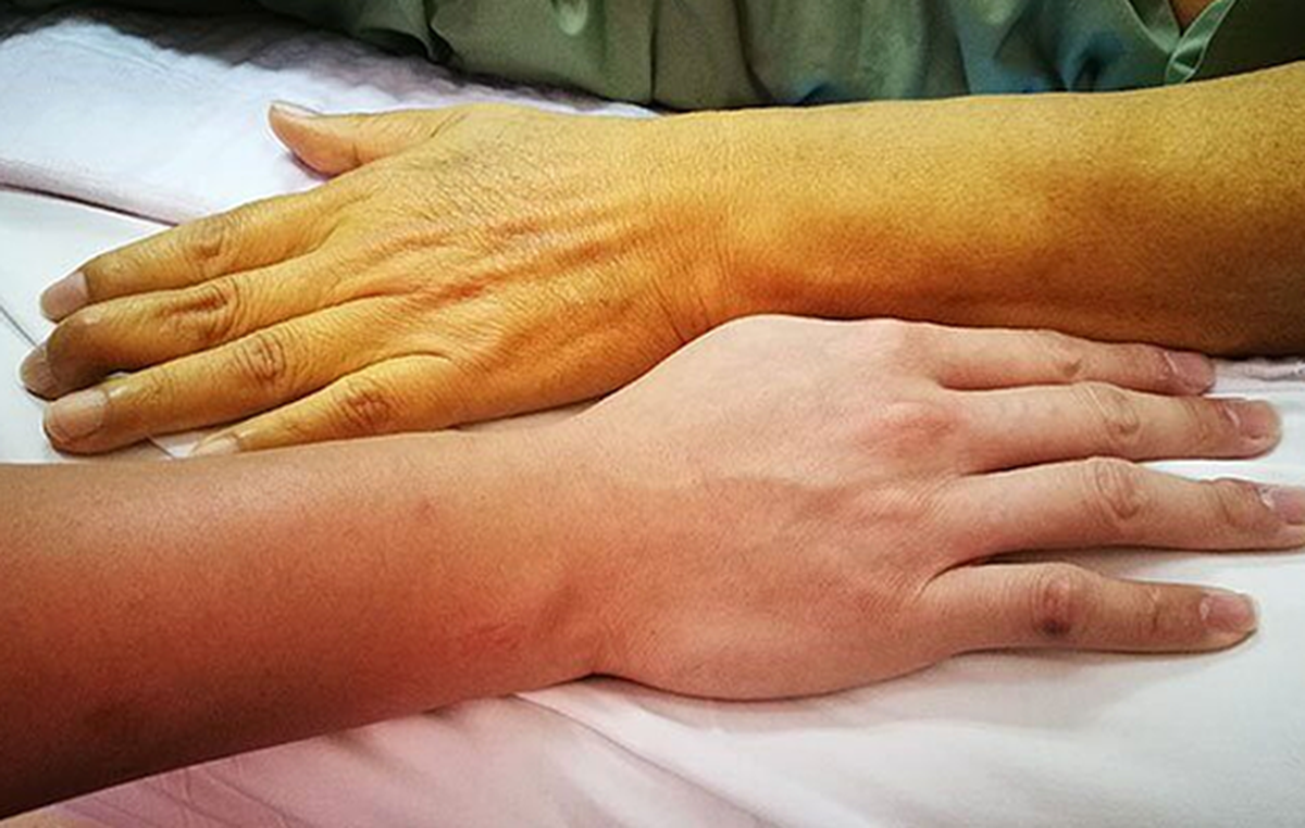 Bác sĩ chỉ rõ: Người có 4 đặc điểm này, ít nguy cơ mắc ung thư