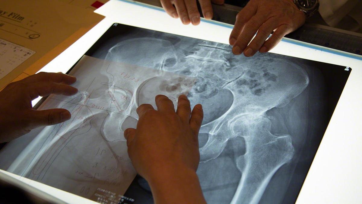 Cụ bà 70 tuổi có xương trẻ khỏe như phụ nữ 30, bác sĩ kinh ngạc khi biết bí quyết